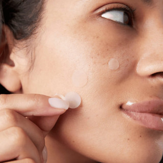 Dán Mụn So'Natural Red Tock - 88 Miếng