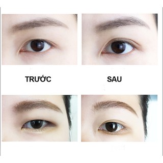 Cuộn dán kích mí CUỘN TRÒN vân lưới 600 miếng