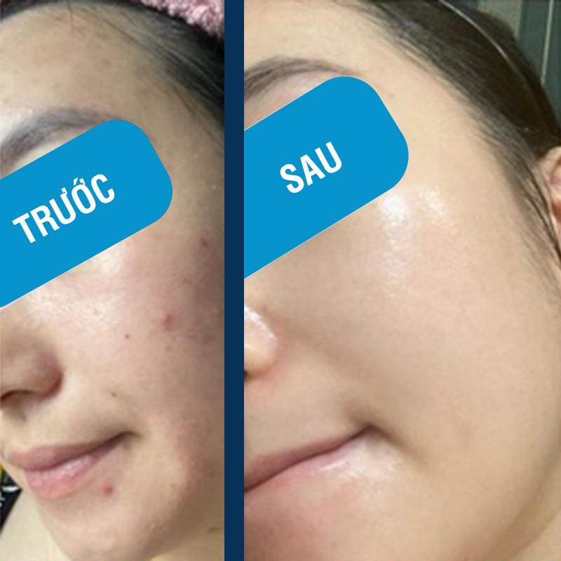 Mặt nạ B5 Repair Control EGF YUEJIN Phục hồi, cấp ẩm da , nâng cơ ngừa lão hóa và nếp nhăn / Subeo Beauty