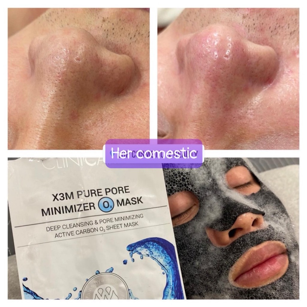 Mặt nạ sủi bọt detox Clinicare X3M Pure Pore Minimizer Mask