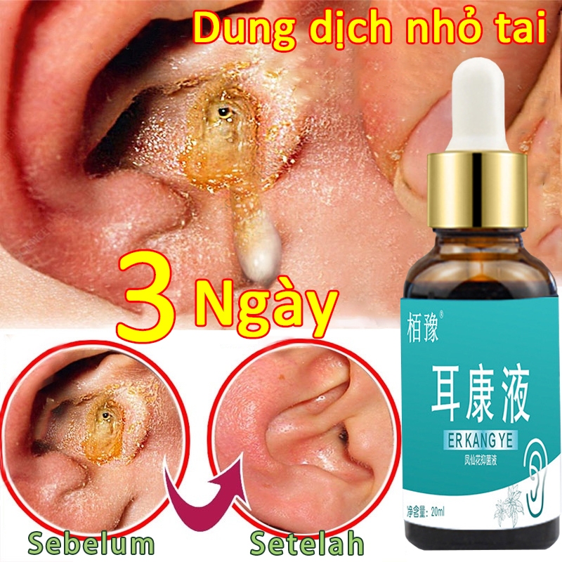 Dung dịch nhỏ tai giảm lãng tai,ù tai,điếc,sưng tai,ngứa tai,viêm tai,đau tai,tan ráy tai,chăm sóc tai bé và người lớn