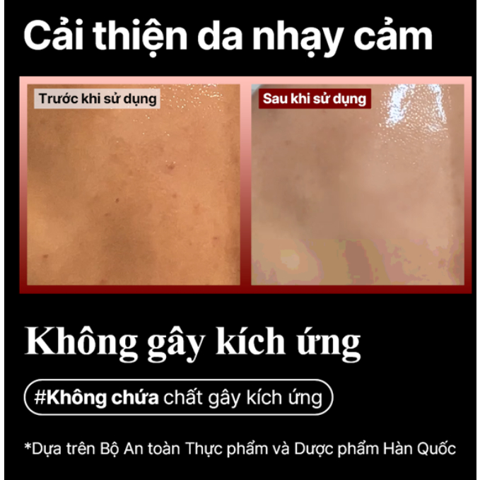 Sữa tắm cho da mụn RED ACNE BODY WASH 400ml