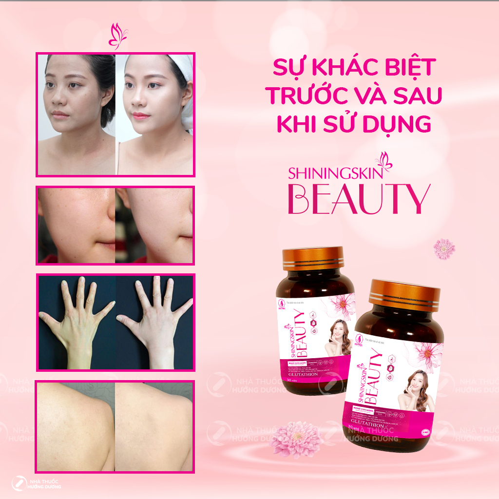 Viên Uống Dưỡng Trắng Da ShiningSkin Beauty - Nâng tông sáng đẹp da hiệu quả và giảm triệu chứng Khô da Nhăn da Nám da