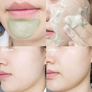 sữa rửa mặt ngải cứu