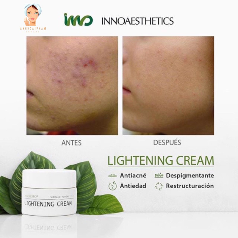 Kem Peel A Lightening retinol Innoaesthetics trắng và hỗ trợ mụn da