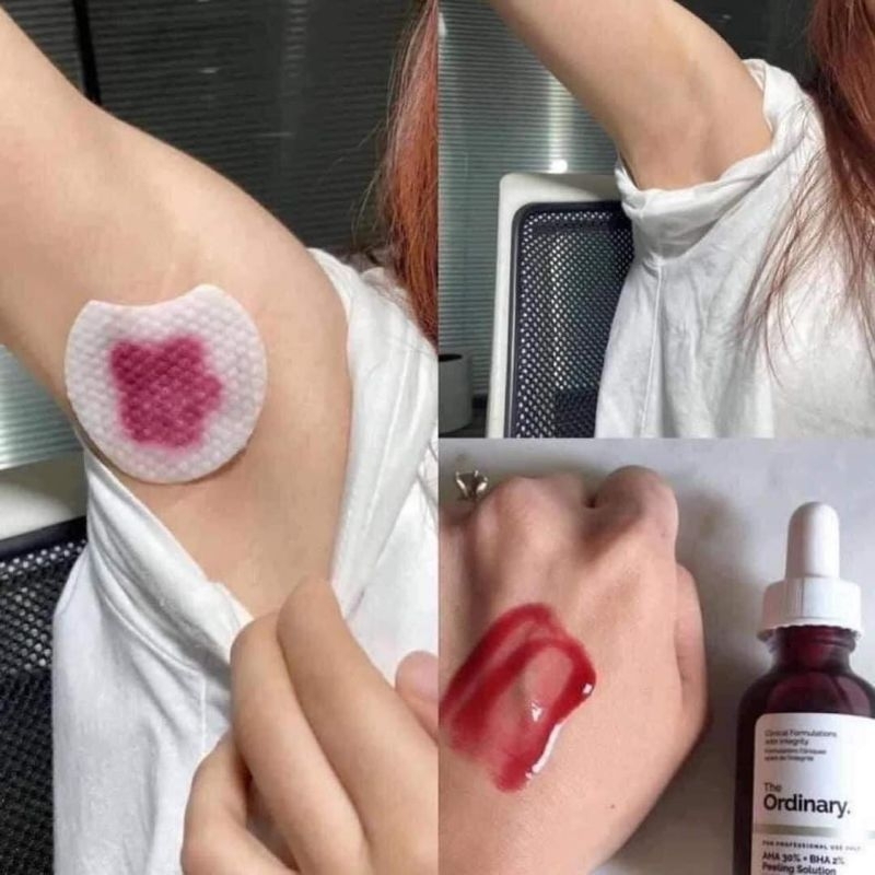 Tẩy Tế Bào Chết Hóa Học 30ml