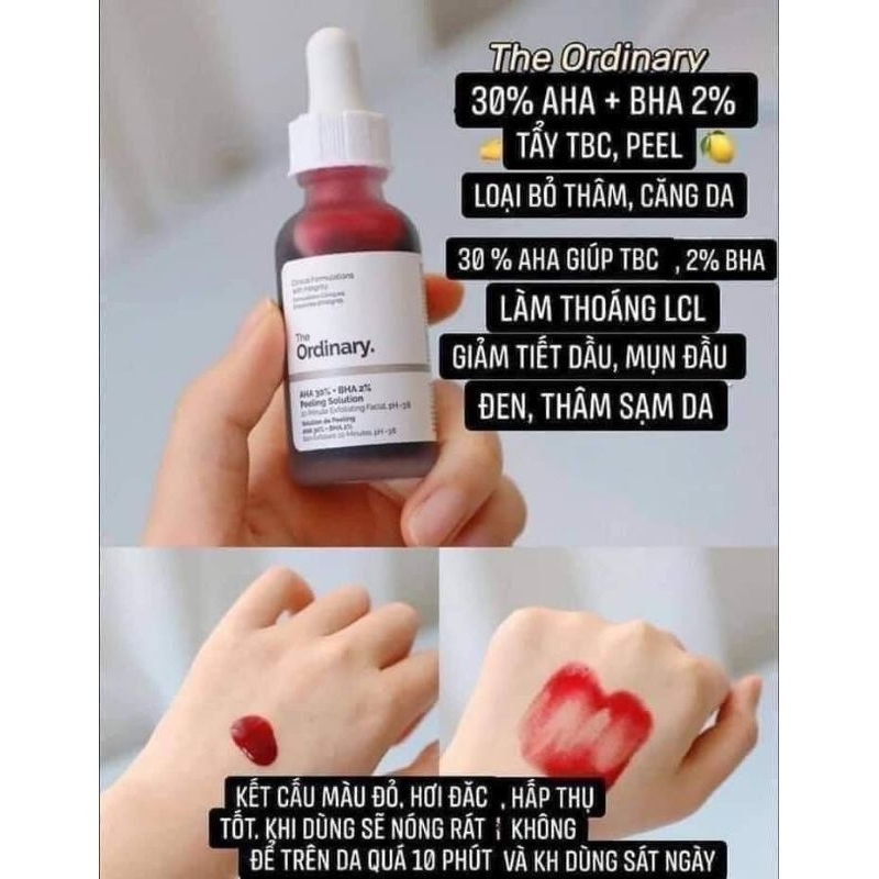 Tẩy Tế Bào Chết Hóa Học 30ml