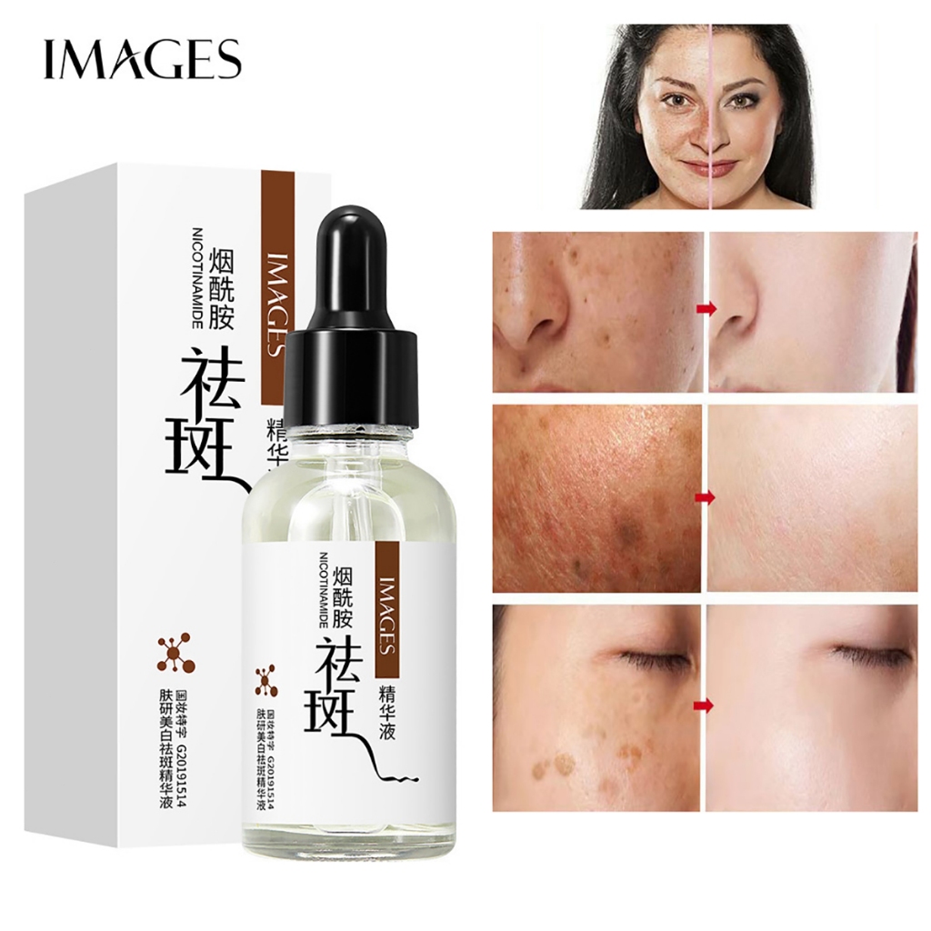 Serum nám tàn nhang Tinh chất làm trắng sạch tàn nhang serum trắng da Loại bỏ đồi mồi nám hỗn hợp thâm mụn hắc tố