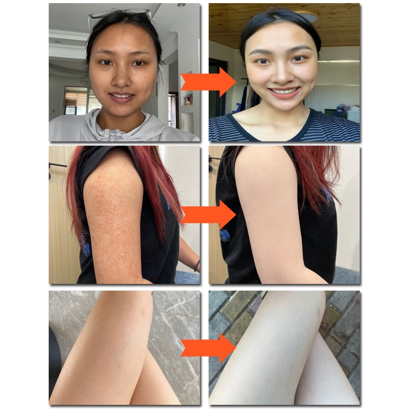 Kem tẩy tế bào chết toàn thân tẩy tế bào chết niacinamide kem tẩy tế bào chết Làm trắng, thu nhỏ lỗ chân lông 250G