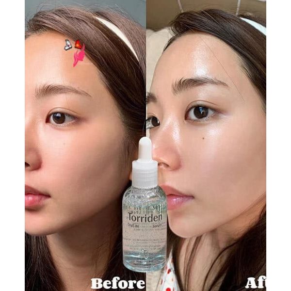 Serum Torriden Hàn Quốc 50ml. Dive In