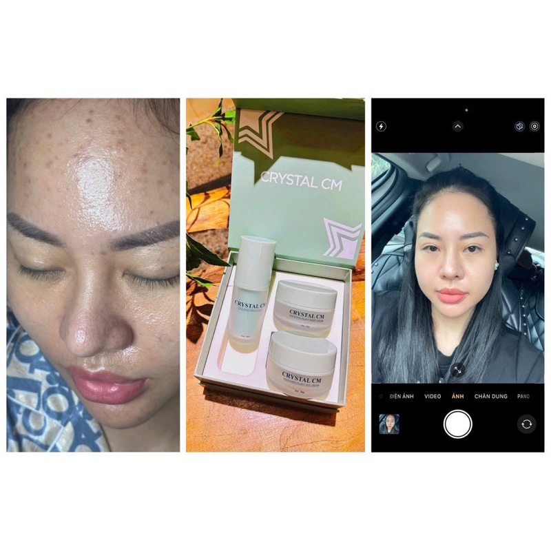 KEM FACE CRYSTAL CM MỜ THÂM NÁM TÀN NHANG