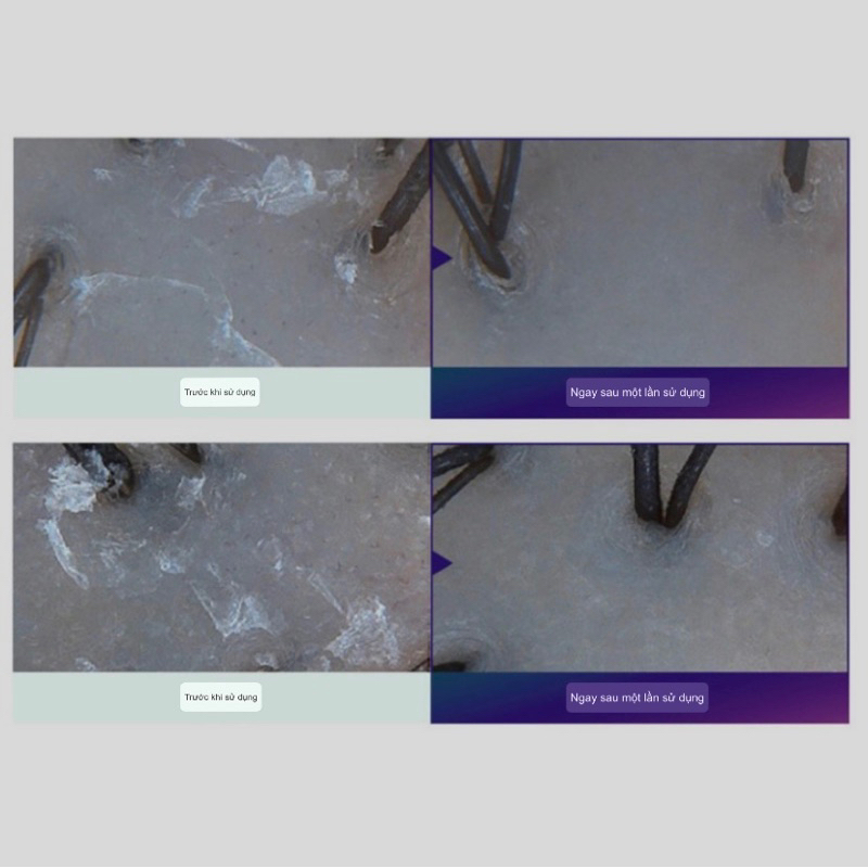 Dầu gội Dr.Groot Microbiome Genetic 7 Scaling Shampoo 400ml