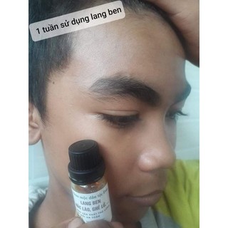 Thảo mộc bôi lang ben TKH