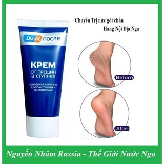 Kem trị nứt gót chân Kpem xách Nga