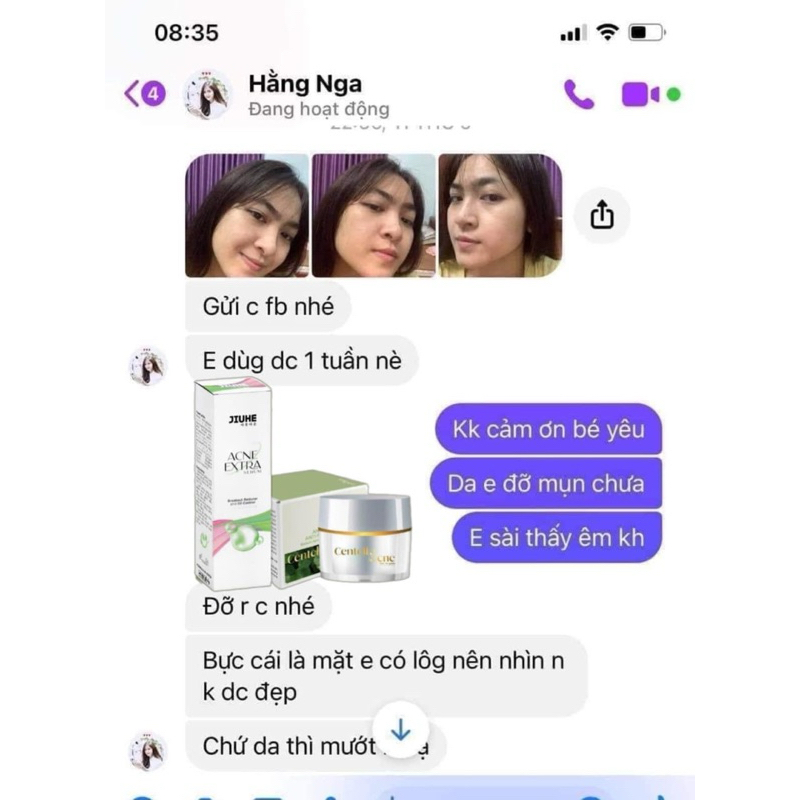 Combo Face Rau Má + Serum Mụn