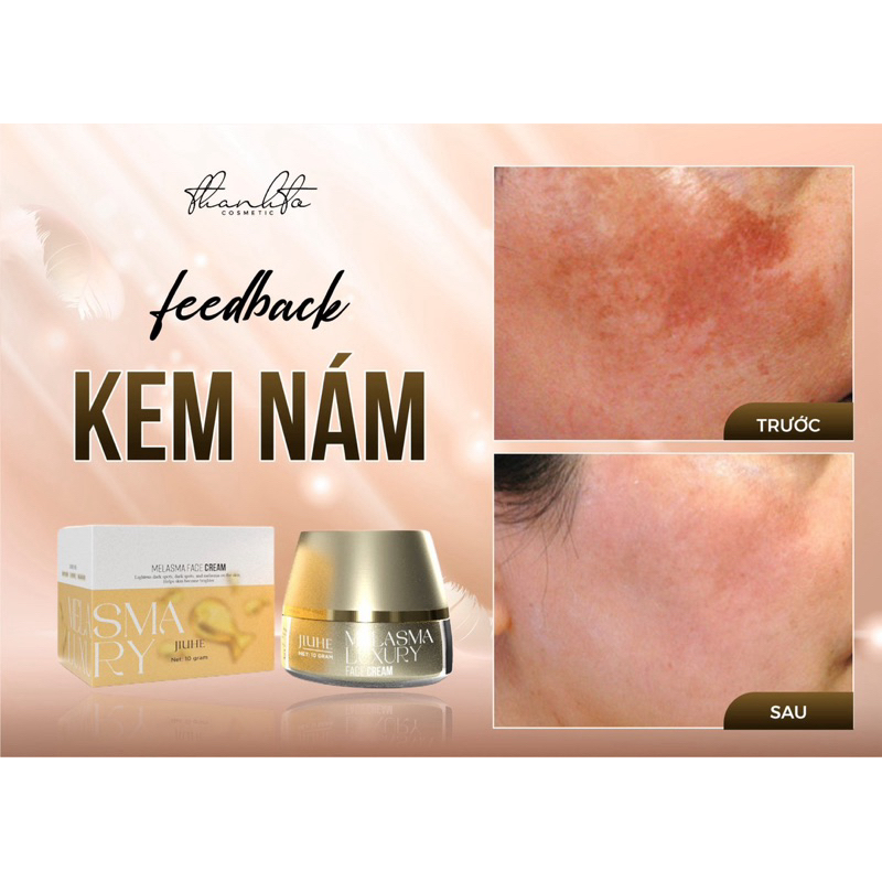 Combo Face Nám + Serum Nám