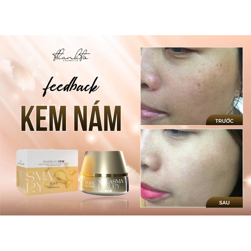 Combo Face Nám + Serum Nám