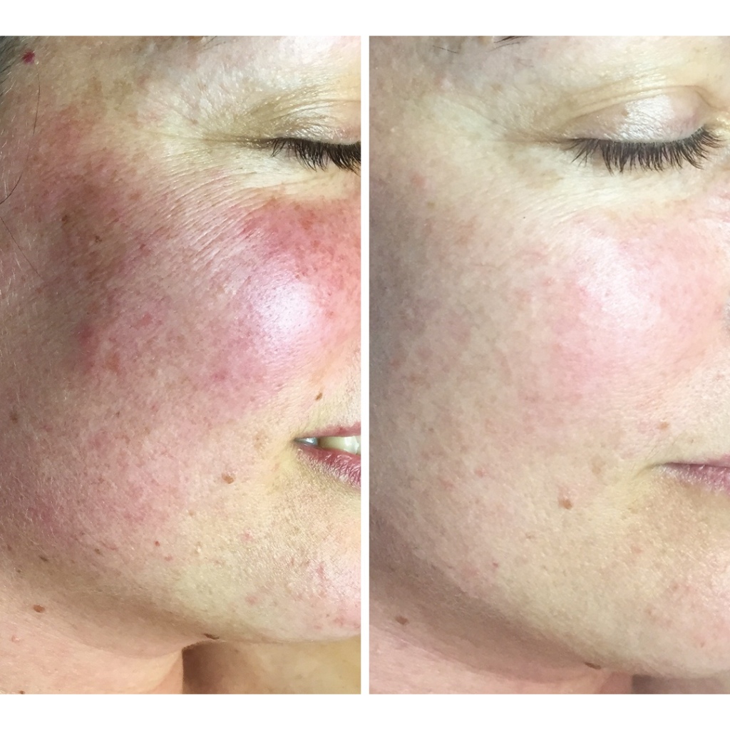 GiGi Recovery Redness Relife Cream - Kem dưỡng làm dịu, phục hồi, tái tạo da 250ml