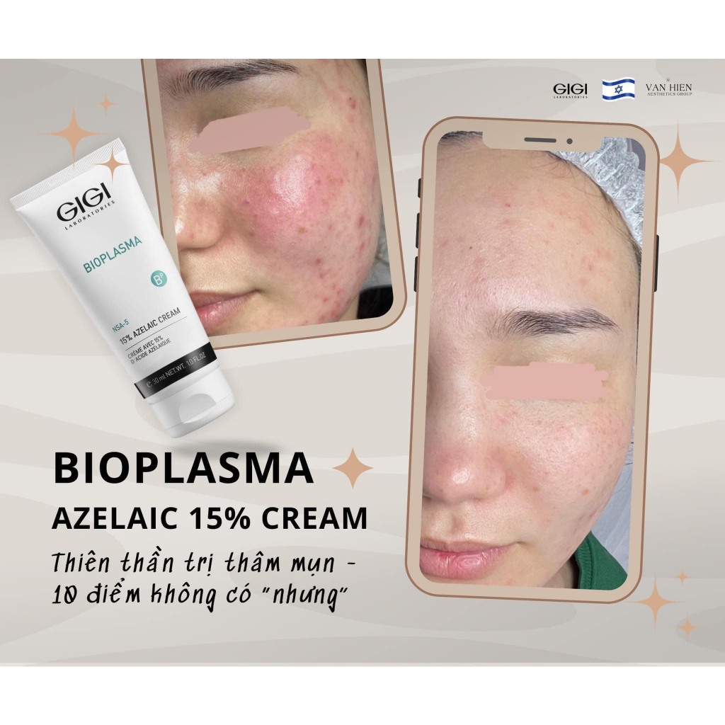 Gigi Bioplasma Azelaic Cream 15% - Kem giảm mụn và thâm nám 30ml