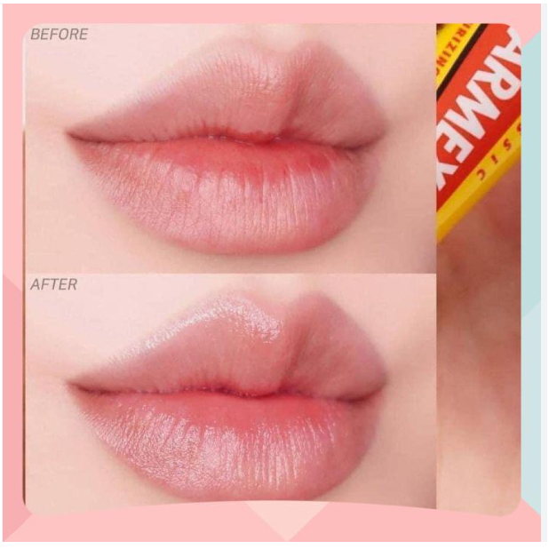 Son Dưỡng Mềm Môi Dạng Tuýp Carmex Classic 10gr