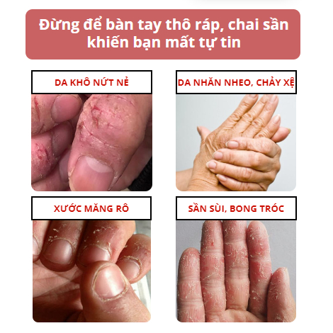 Tinh chất phục hồi trẻ hóa da tay ROSE MANOR - ROSE MANOR dưỡng chất giúp da tay mềm mại, giảm thô ráp, mịn màng