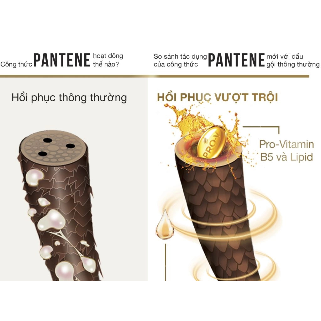 Dầu xả Pantene ngăn rụng tóc 300ml