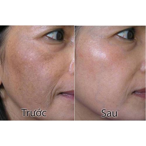 Kem CM® linh chi đỏ Chiu -Mien, dưỡng trắng da, sáng da, ngăn ngừa lão hóa SPF30 - 50g