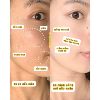 Tinh Chất Dưỡng Sáng Da Mar.ti.derm DSP Bright Pigment Zero