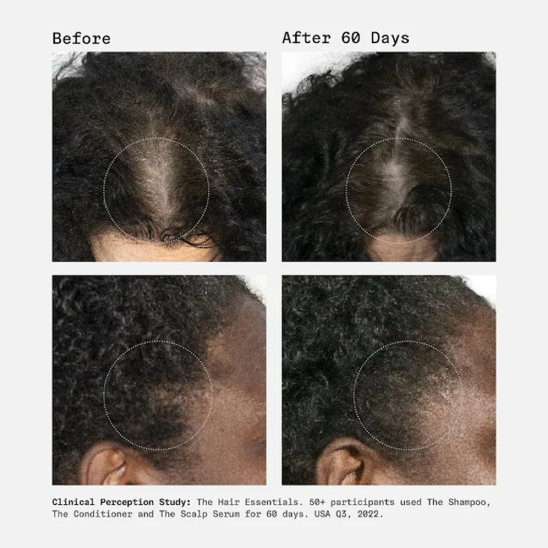 Tinh chất hỗ trợ giảm rụng tóc Nécessaire The Scalp Serum - With 5% Biomimetic Peptide Blend For Hair Growth