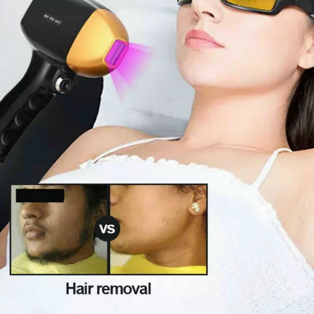 Máy triệt lông 𝑫𝑰𝑶𝑫𝑬 𝑳𝑨𝑺𝑬𝑹 𝑴𝑬𝑫808𝒏𝒎 Hàng Cao Cấp