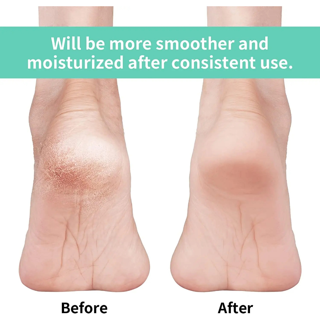 Cặp Vớ silicone gel Chăm Sóc Da Chân Chống Nứt Nẻ