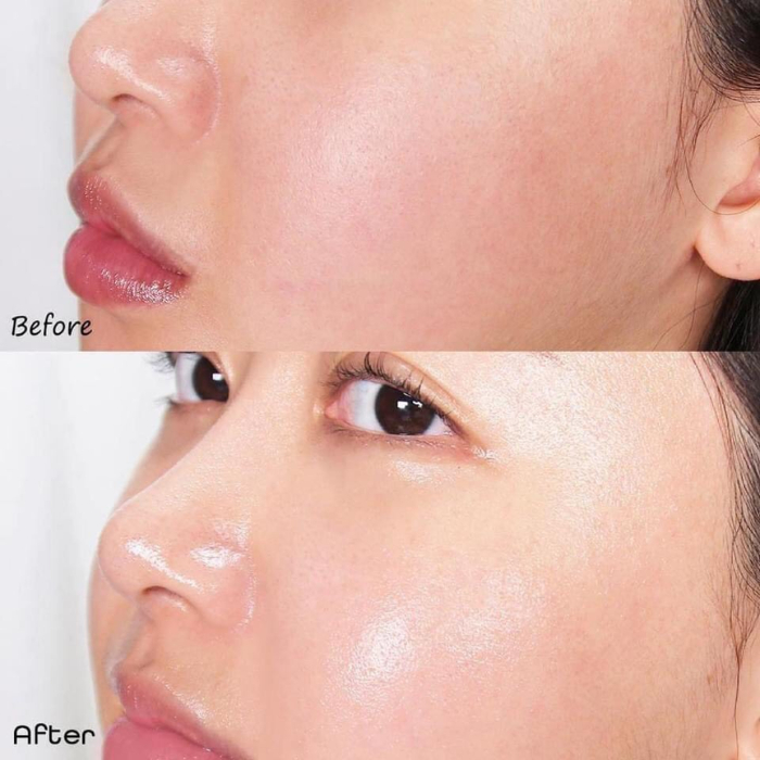 Serum Vitamin C 561 Esthepro Dưỡng Trắng Da Ngăn Ngừa Lão Hoá 100ml Hàn Quốc