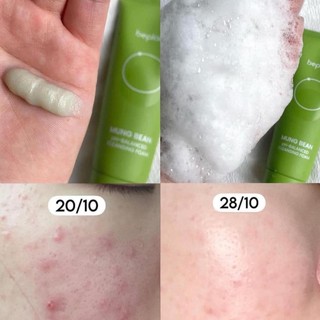 Sữa Rửa Mặt Beplain Mung Bean Cleansing Foam