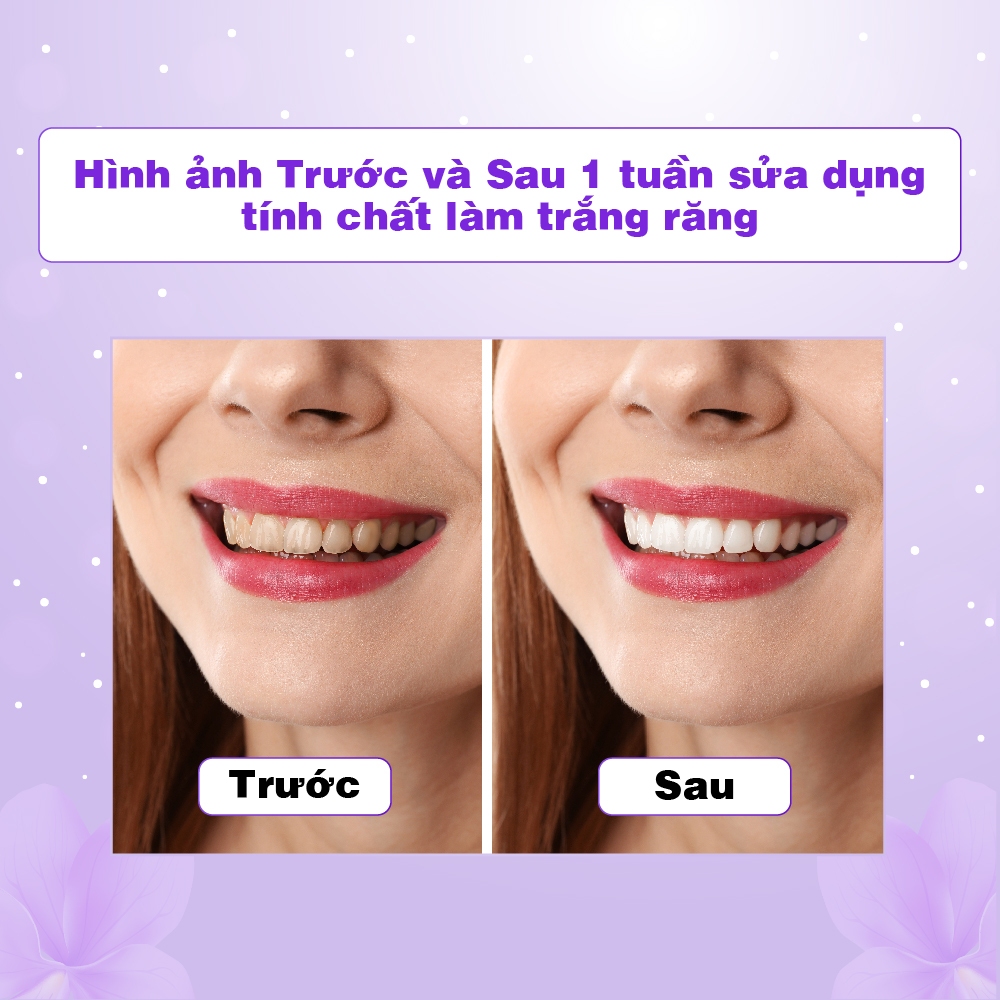 Tinh chất trắng răng V34, Serum trắng răng V34 an toàn tại nhà,trắng răng hiệu quả - Unipharma - 90ml