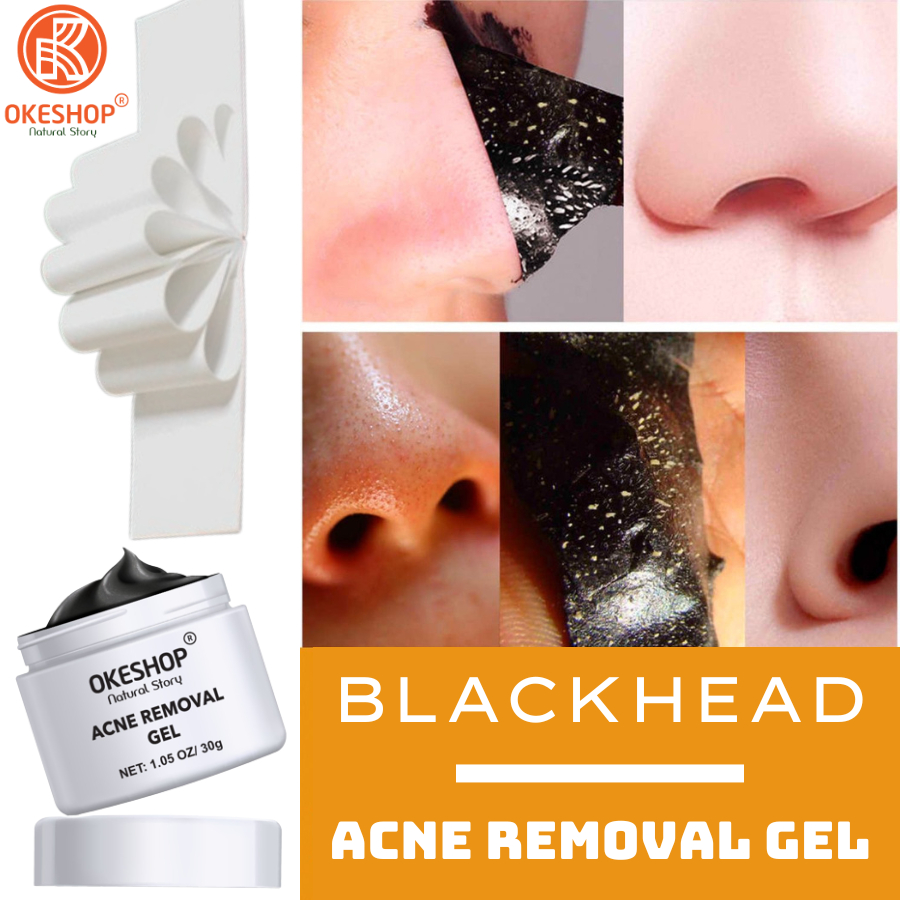 Gel Lột Mụn Nha Đam OKESHOP 30ml - Giải Pháp Loại Bỏ Mụn Đầu Đen - Mụn Cám - Bạ Nhờn - Sạch Sâu Và Thu Nhỏ Lỗ Chân Lông