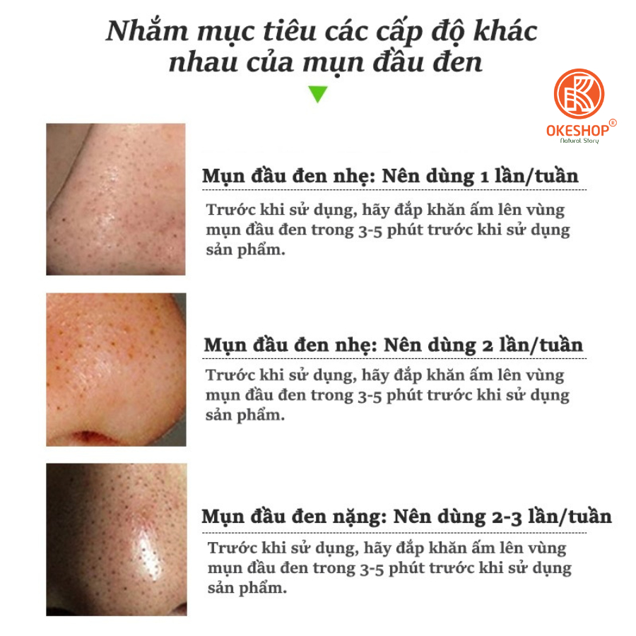 Gel Lột Mụn Nha Đam OKESHOP 30ml - Giải Pháp Loại Bỏ Mụn Đầu Đen - Mụn Cám - Bạ Nhờn - Sạch Sâu Và Thu Nhỏ Lỗ Chân Lông
