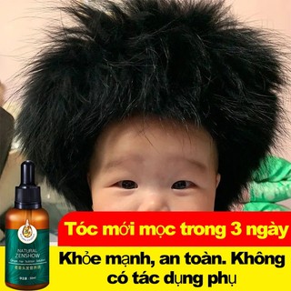 Tinh chất mọc tóc tinh dầu mọc tóc 30ml serum kích mọc tóc chăm sóc tóc chống rụng tóc,kích thích tóc mọc dà