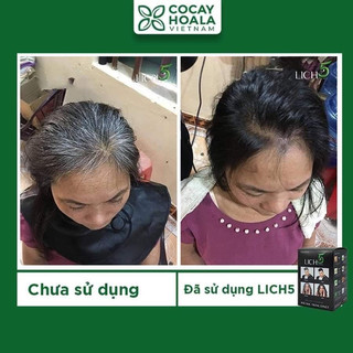Phủ Bạc Tóc Lich5 Ona Cỏ cây hoa lá [Chính hãng] Date T5/ 2027