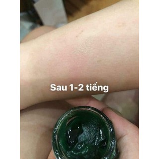 Kem Bôi muỗi đốt Thái Lan
