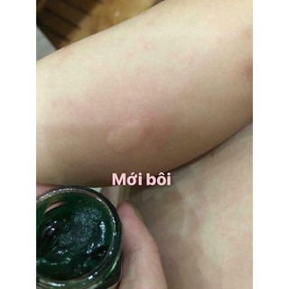 Kem Bôi muỗi đốt Thái Lan