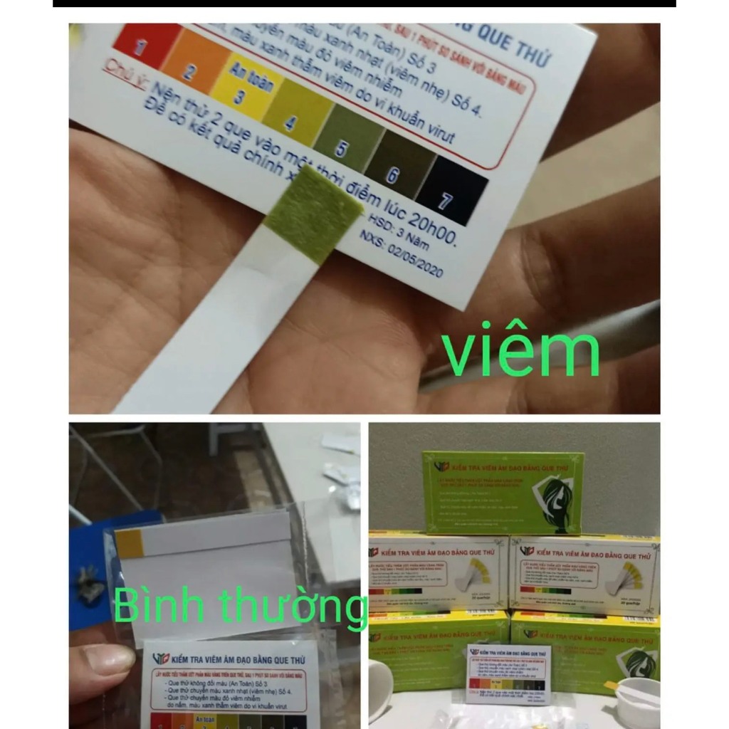 Que kiểm tra viêm âm đạo chuẩn 99%