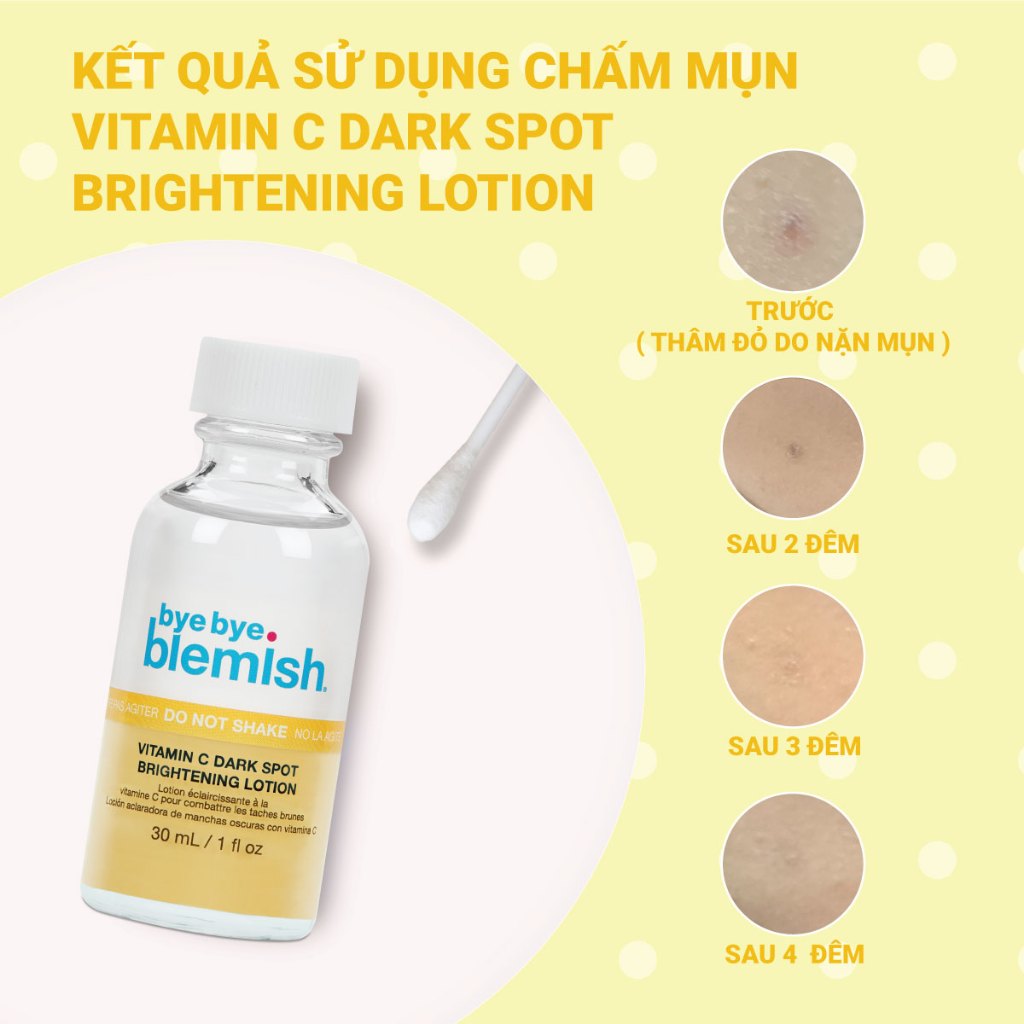 Chấm Mụn Vitamin C Giảm Mụn Nhanh Sau 1 Đêm Dành Cho Da Mụn Thâm Bye Bye Blemish Vitamin C Dark Spot Brightening