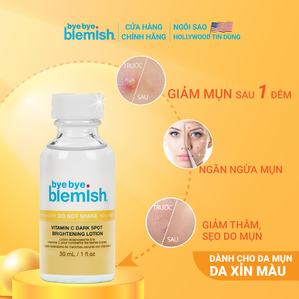 Chấm Mụn Vitamin C Giảm Mụn Nhanh Sau 1 Đêm Dành Cho Da Mụn Thâm Bye Bye Blemish Vitamin C Dark Spot Brightening