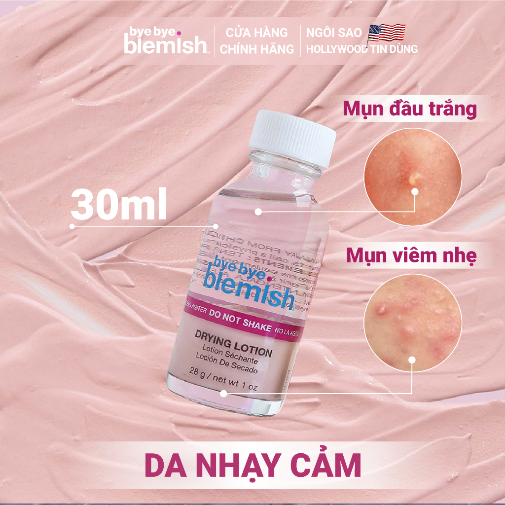 Chấm Mụn Giảm Mụn Nhanh Sau 1 Đêm Dành Cho Mụn Trắng, Sưng Đỏ Bye Bye Blemish Original Drying Lotion 30ml