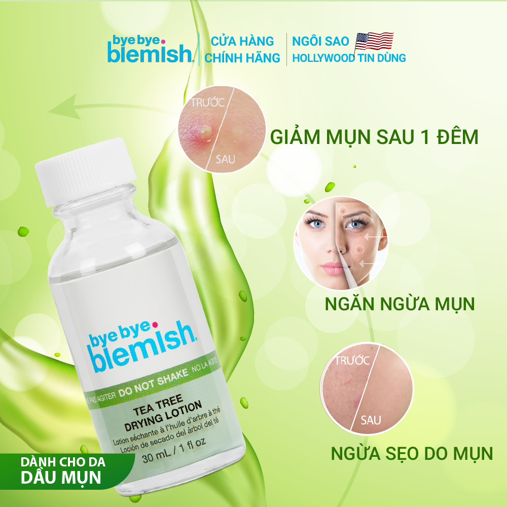 Chấm Mụn Tràm Trà Giảm Mụn Nhanh Dành Cho Mụn Sưng Viêm, Mụn Mủ Bye Bye Blemish Tea Tree Drying Lotion 30ml