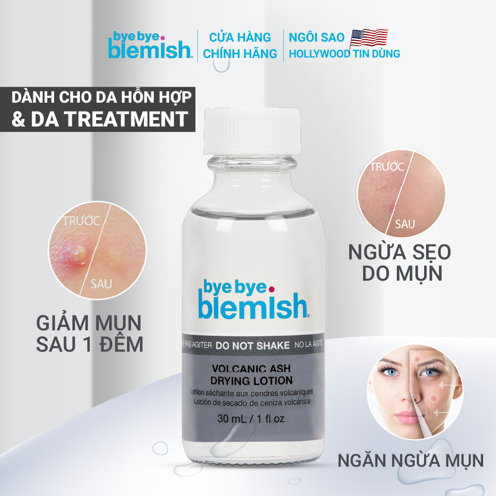 Chấm Mụn Tro Núi Lửa Giảm Mụn Nhanh Dành Cho Mụn Trắng, Sưng Đỏ Bye Bye Blemish Volcanic Ash Drying Lotion