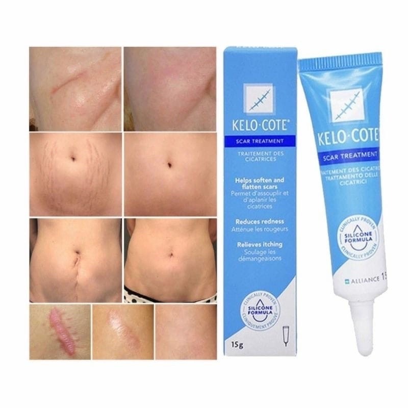 Gel xoá sẹo lồi, sẹo thâm, sẹo rỗ, sẹo lâu năm Kelo-Cote 6g