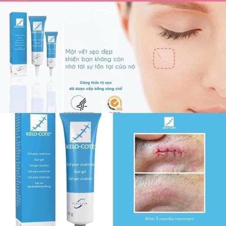 Gel xoá sẹo lồi, sẹo thâm, sẹo rỗ, sẹo lâu năm Kelo-Cote 6g