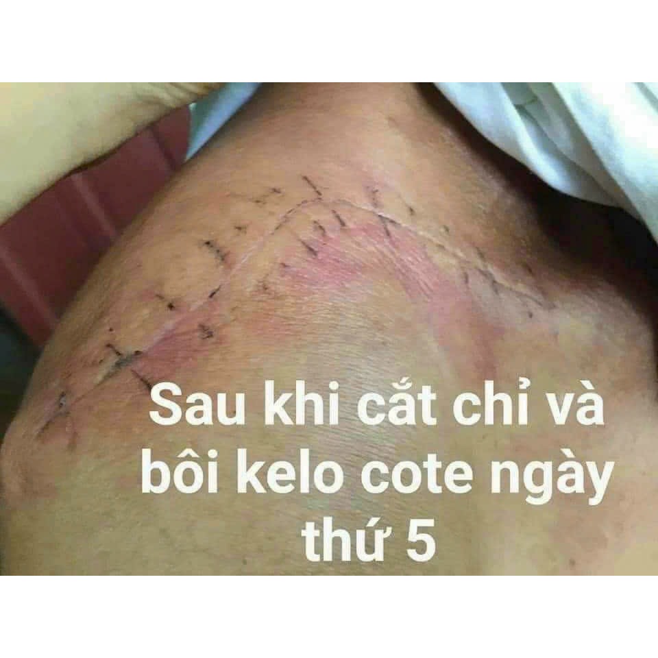 Gel xoá sẹo lồi, sẹo thâm, sẹo rỗ, sẹo lâu năm Kelo-Cote 6g