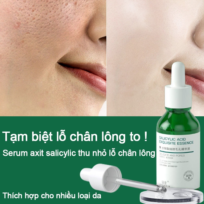 Serum se khít lỗ chân lông 30ml Tinh Chất Salicylic Acid Thu nhỏ lỗ chân lông Giảm mụn đầu đen Dưỡng ẩm và làm trắng da